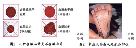 新生兒采血卡廠(chǎng)家解讀：新生兒篩查